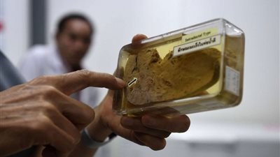 ثلاث عادات تدمر الكبد