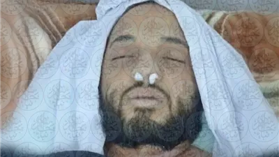 مصرع نجل أمير تنظيم القاعدة جراء حريق في مأرب اليمنية