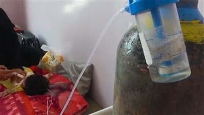 الأمم المتحدة: 20 مليون شخص في اليمن يحتاج للمساعدات وندعو الحوثيين للإفراج عن موظفينا