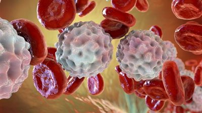 بجمع عقارين..علاج واعد لأحد أخطر أنواع سرطان الدم