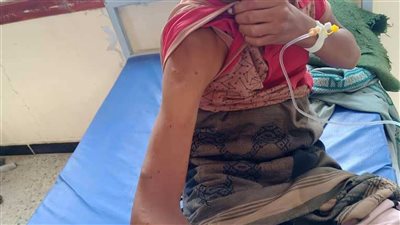 لحج.. مليشيا الحوثي الإرهابية تستهدف طفلًا بطلق ناري في كرش